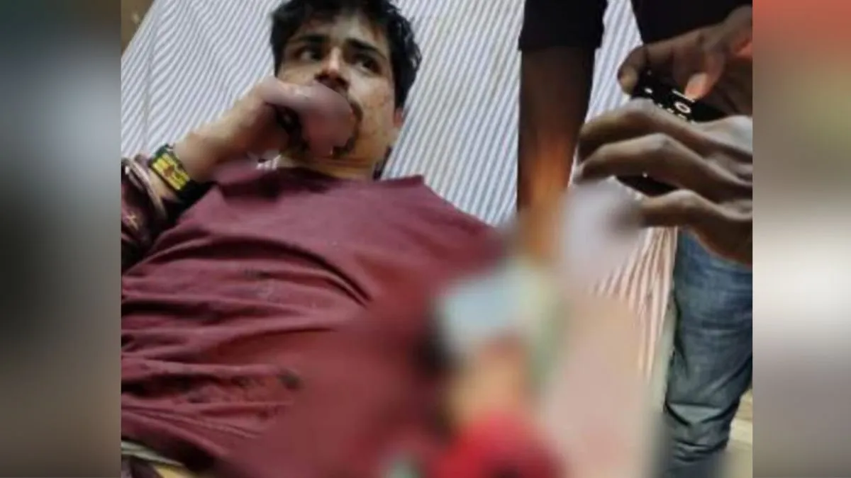 नशे की हालत में रेलवे ट्रैक पर लेटा था युवक, ट्रेन से कट गया हाथ, एम्बुलेंस से भी कूद कर भागा